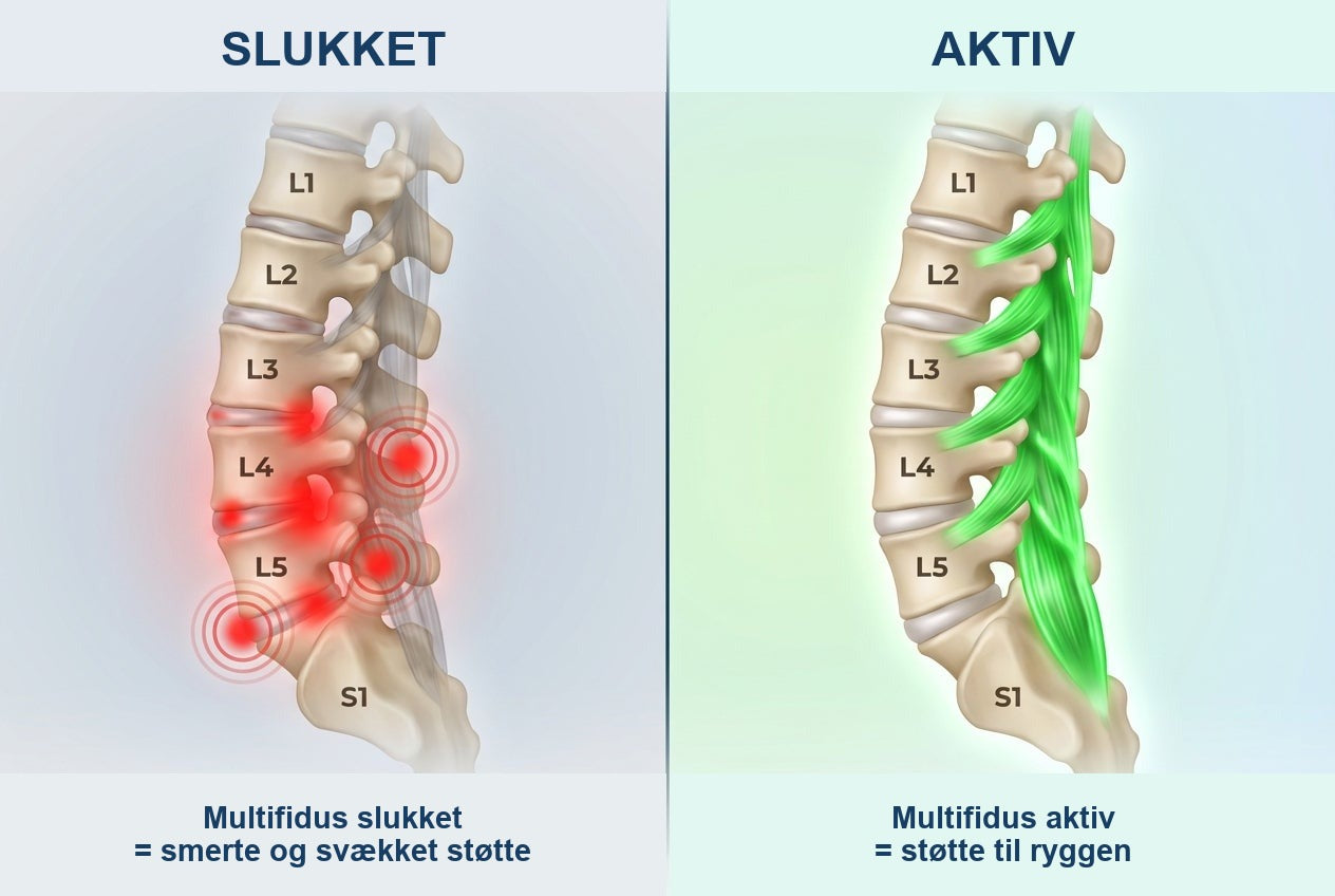 Illustration af multifidus i ryggen